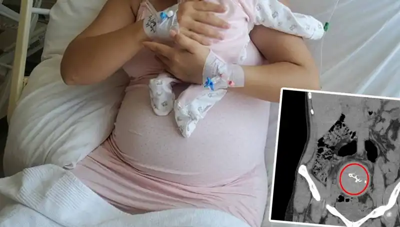 Doğumda Unutulan Bebek İçin Soruşturma: Gazlı Bez İhmalinin Sonuçları