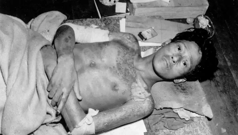 80 Yıl Sonra Nagasaki’den Ürkütücü Uyarı: Nükleer Felaket Ayaklarımıza Geldi