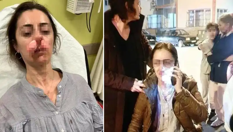 Otomobil Kapısı Silah Sayıldı: Eşinin Sevgilisi Sanarak Saldırdı!